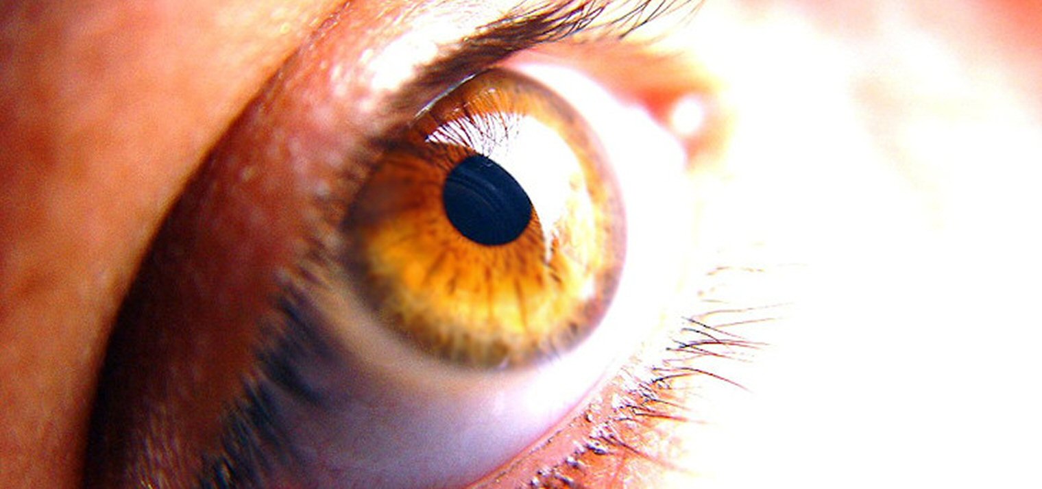 Close-Up of an Eye Gazing Upwards