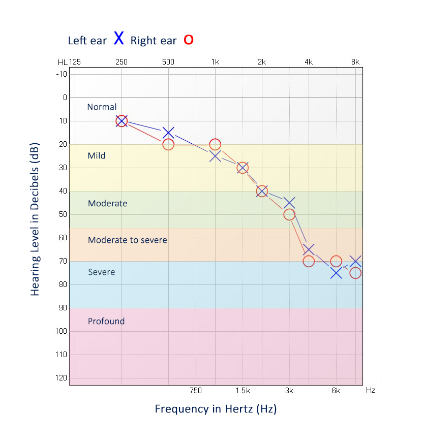Audiogram example in house image