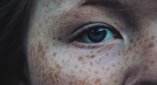 Freckled face