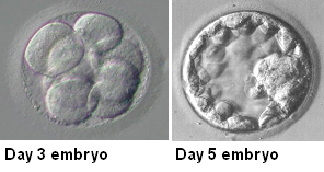 Embryo Culture and Transfer