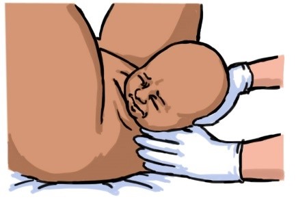birth