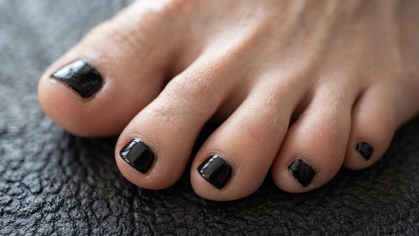 close up of toenails